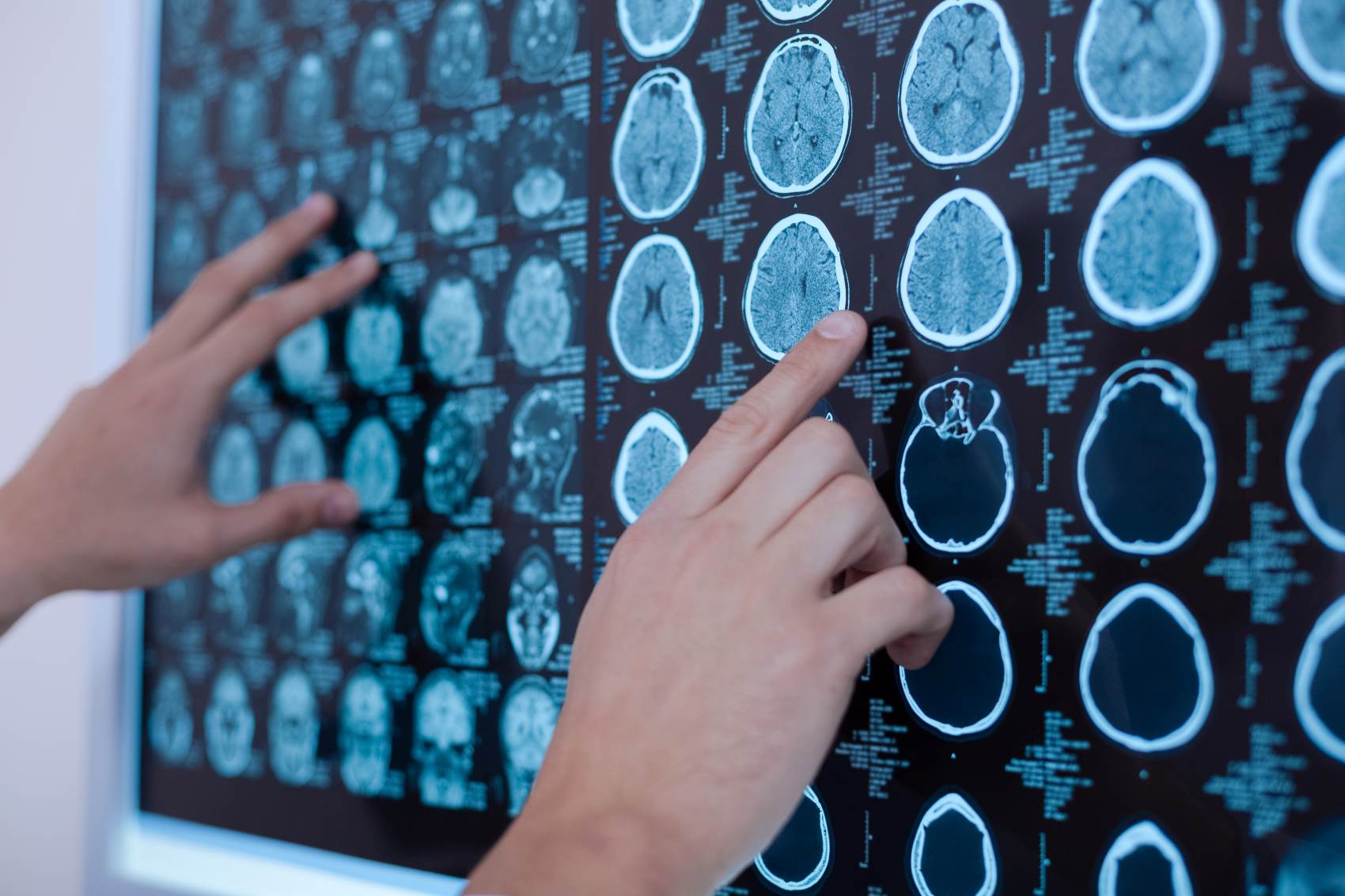 Scaling AI in the NHS to transform health operational efficiencies in 2025