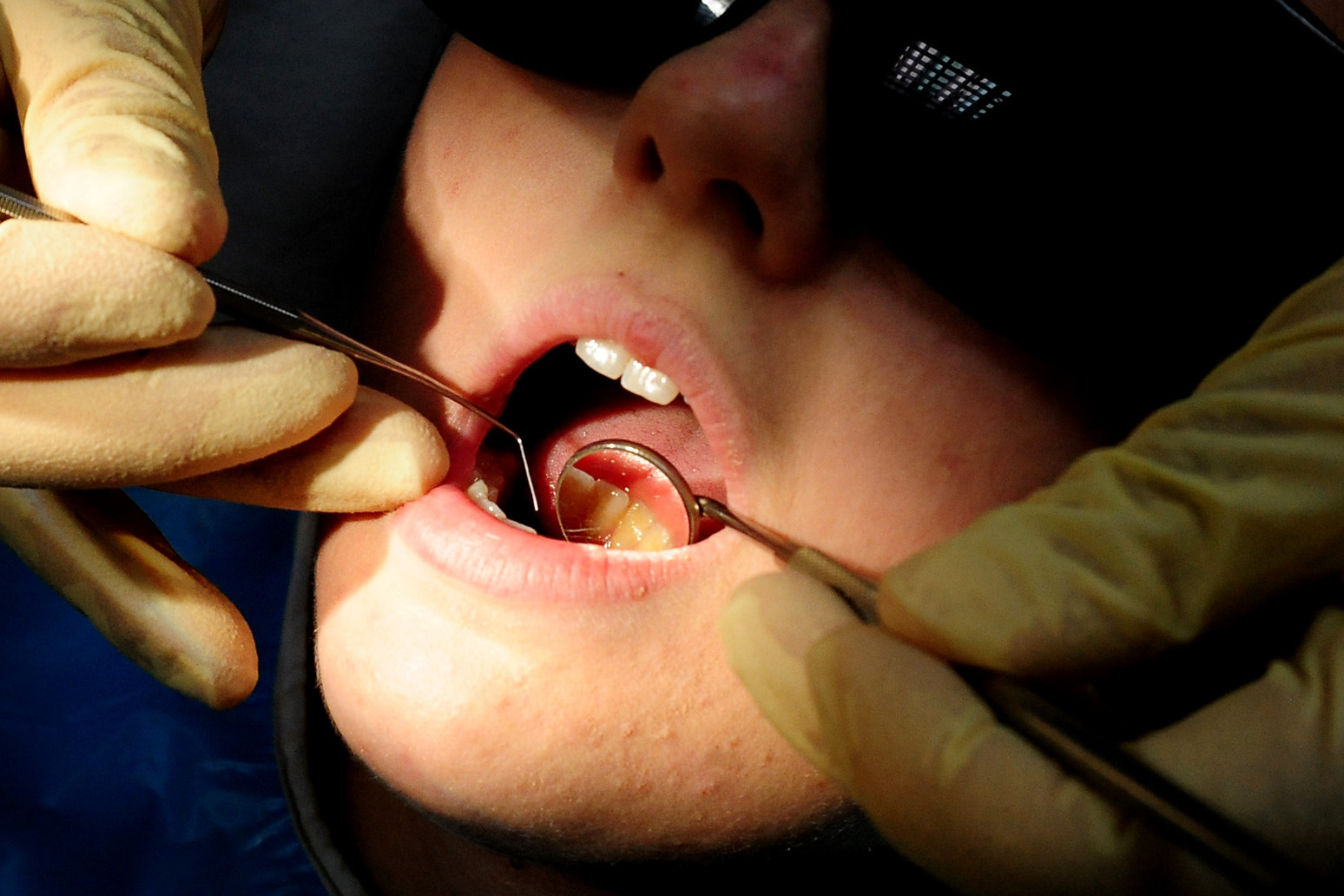 2.2 million people in need of urgent NHS dental care