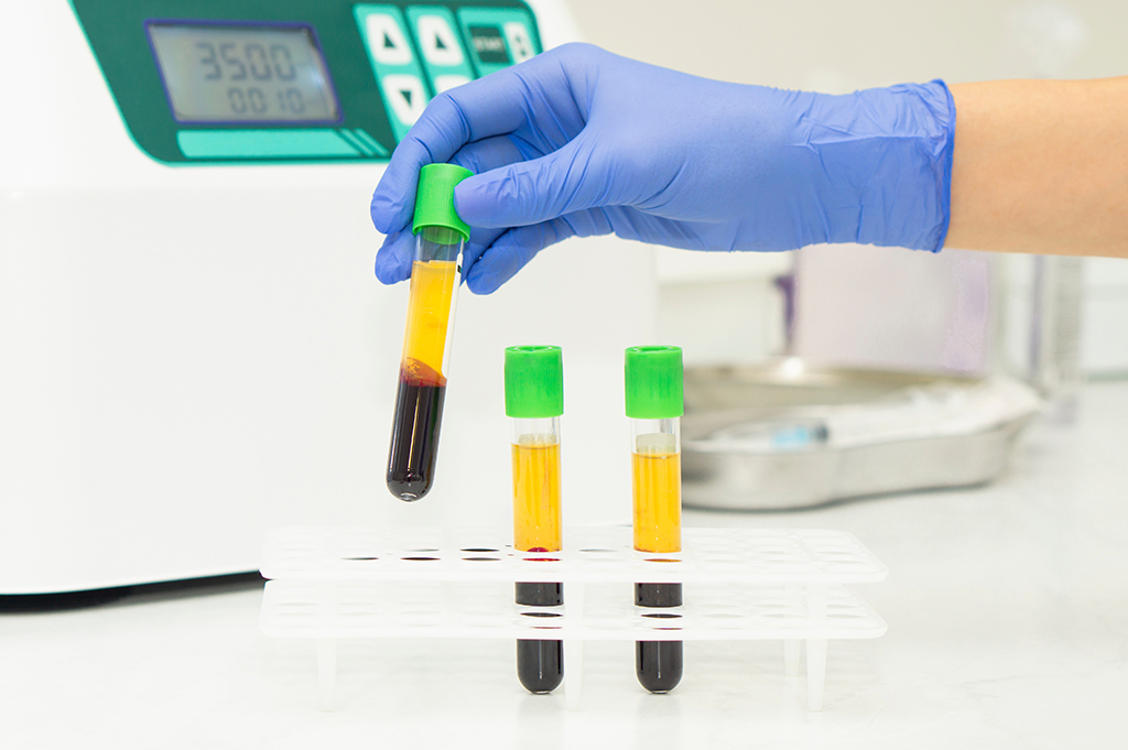 Medicines derived from UK blood plasma distributed to NHS hospitals for ‘first time in a generation’
