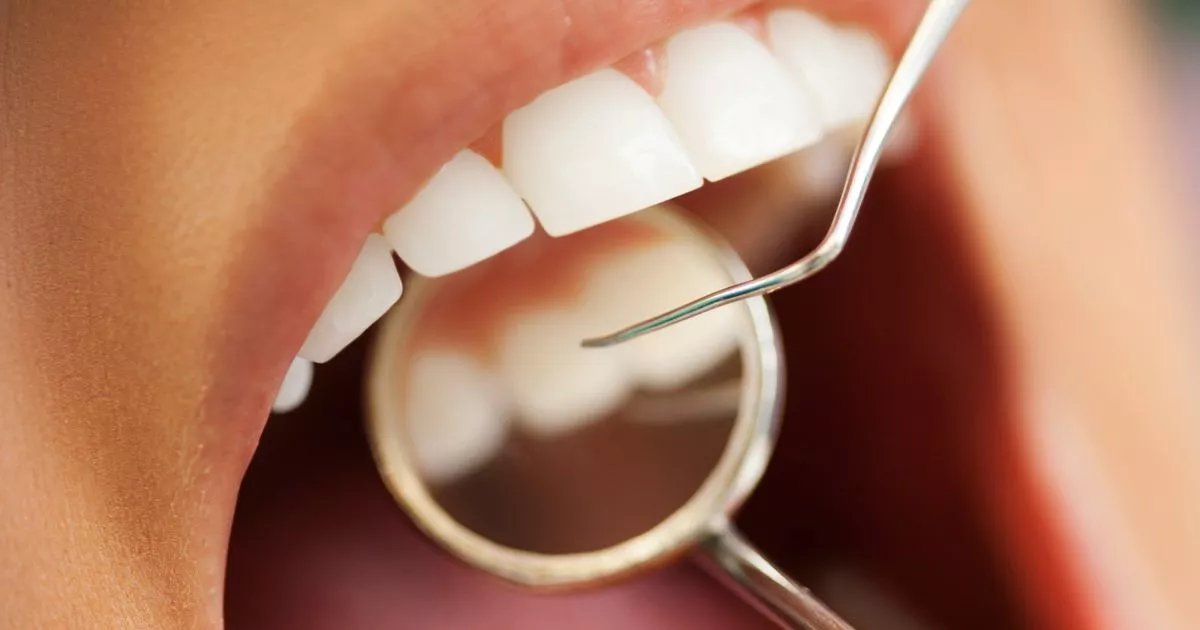 Exact amount people will pay as NHS dental prices set to rise