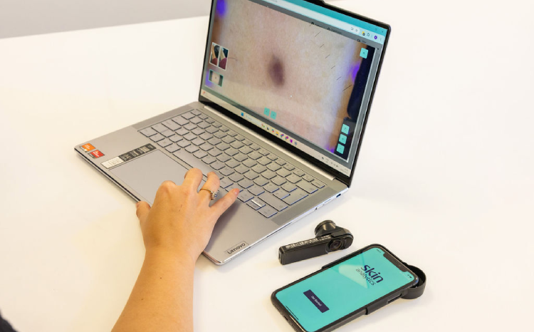 NICE recommends AI skin cancer detection system for NHS use